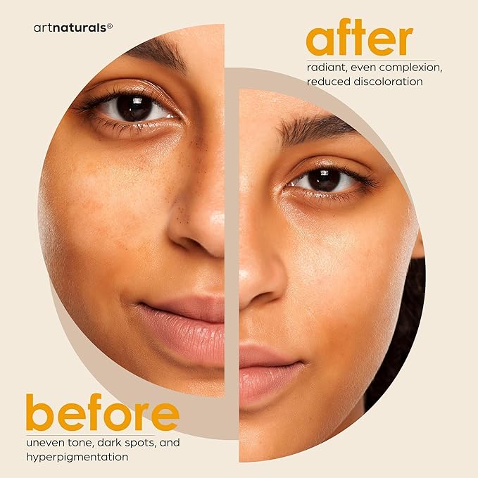 Artnaturals Kojic Acid Soap + African Net Sponge (2 pack X 142g Turmeric bars) Dark spot remover & Scars - Original Japanese Complex Vitamin C, Hyaluronic Acid, retinol, shea butter (Citrus)