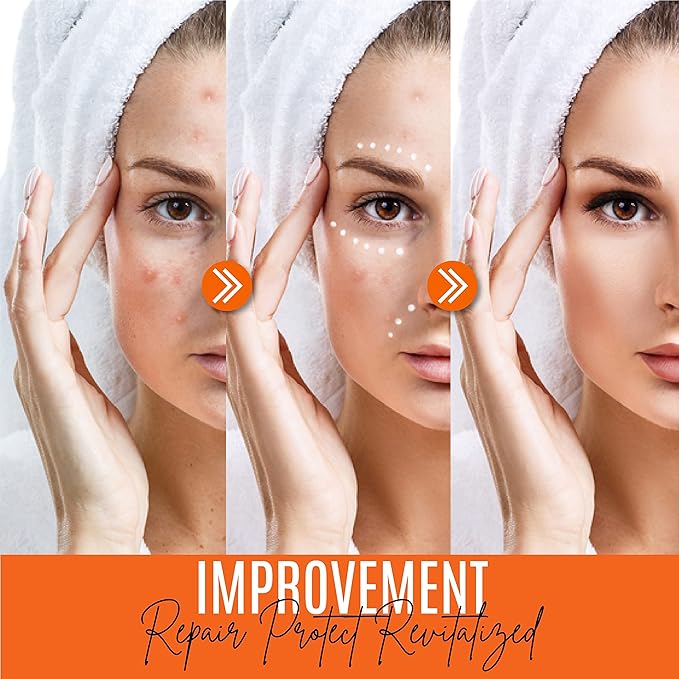 30% Vitamin C Face Serum with Hyaluronic Acid & Vitamin E – Natural Hydrating & Rejuvenating Serum for All Skin Types (4 FL OZ)