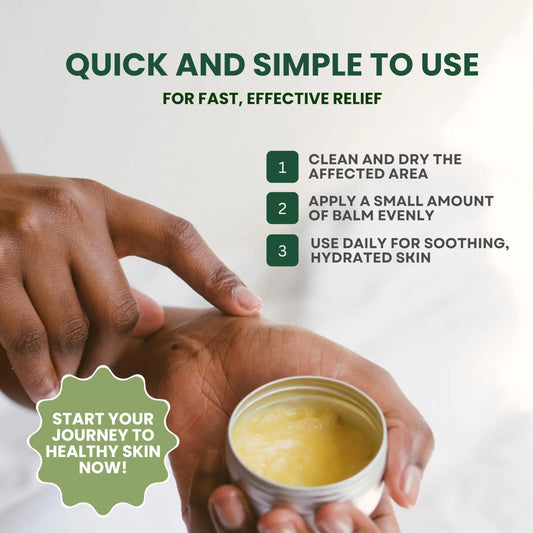 KESMEDIK Tea Tree Oil MaxTherapy Balm, Itchy Skin Relief, Soothing for Rashes, Jock Itch, Athlete’s Foot, Chafing, Insect Bites, Folliculitis, Dry Sensitive Skin, Effective & Safe for All Ages, 1-Pack