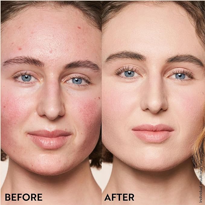 M. Asam Magic Finish Porcelain Teint Make-Up Mousse (1.01 Fl Oz) – 4in1 Primer, Foundation, Concealer & Powder With Buildable Coverage, Adapts To Fair Skin Tones, Leaves Skin Looking Flawless