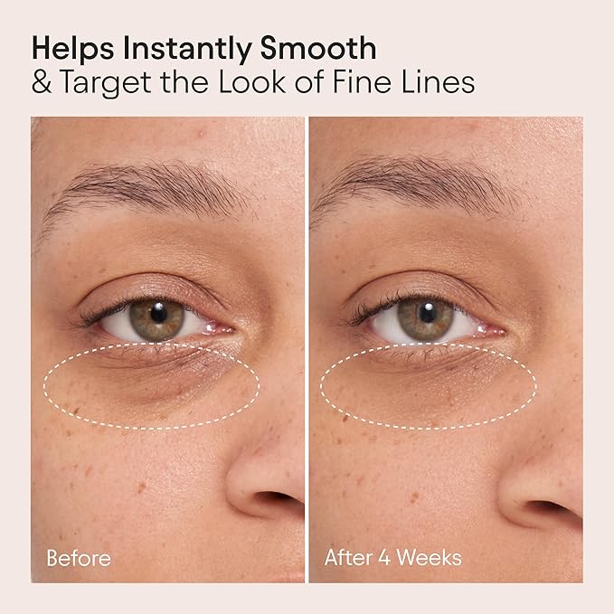 Alpyn Line-Filling Eye Balm with Bakuchiol & Caffeine, Reduce the Look of Fine Lines & Wrinkles, Minimize the Appearance of Puffiness & Target Dark Circles, 0.5 oz / 14 ml