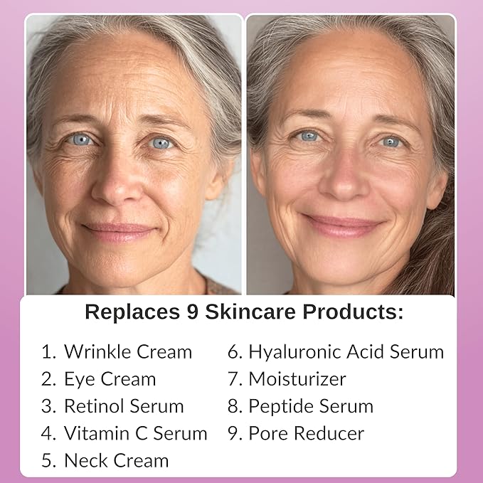 LeVaye Strateva RX Advanced Anti-Aging Serum – Vitamin C, Niacinamide, Natural Retinol, Hyaluronic Acid & Peptides – Targets Wrinkles, Fine Lines, Dark Spots, Dark Circles & Enlarged Pores