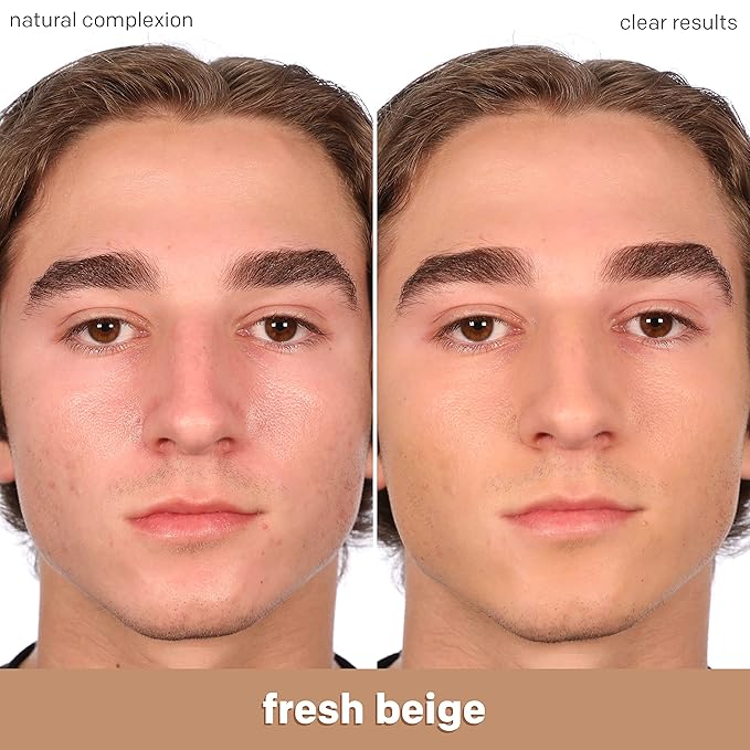 Almay Clear Complexion Acne Foundation Makeup with Salicylic Acid - Lightweight, Medium Coverage, Hypoallergenic, Fragrance Free, for Sensitive Skin, 700 True Beige, 1 fl oz. (Pack of 2)