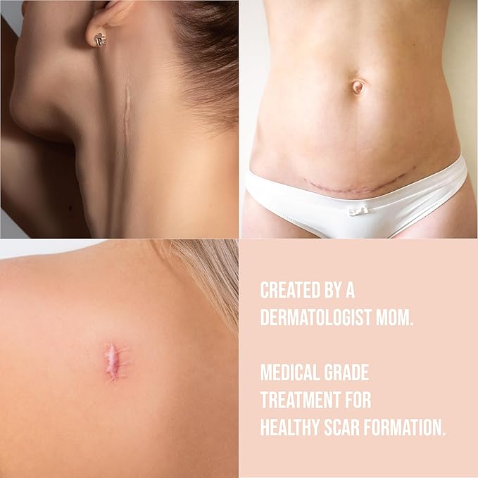 Quitch Silicone Scar Sheets for Surgical Scars, Silicone Scar Tape, C Section Recovery Must Haves, Tummy Tuck Recovery Must Haves, Postpartum Essentials Scar Treatment (Nude) 4x150cm