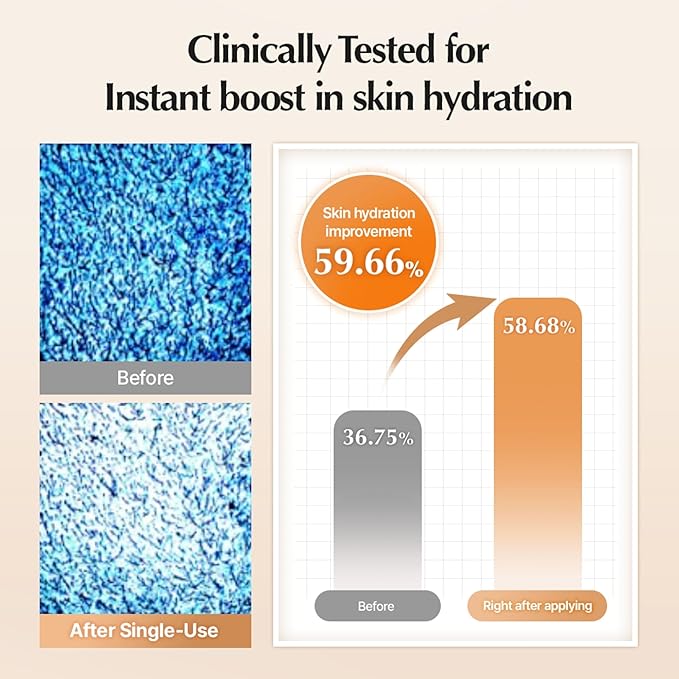 UIQ Biome Barrier Treatment Essence Nourishing, Hydrating, Moisturizing Toner l Korean Skincare for All Skin Types | Daily Gentle Dead Skin Cell Care I Glow Skin Radiance 5.07 fl.oz /150ml