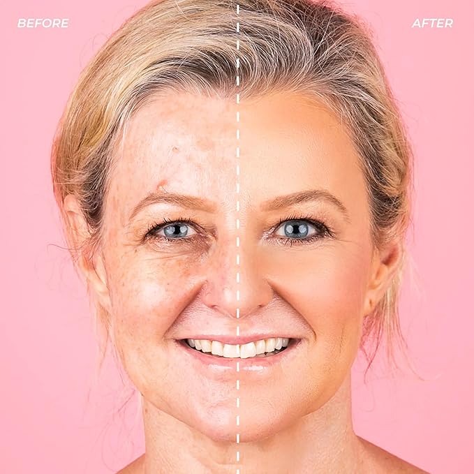 MCoBeauty Instant Concealer Camouflage & Contour, Medium, Perfecting Contour with Flawless Coverage, Vegan, Cruelty Free Cosmetics