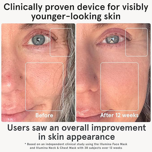 iRestore Red Light Therapy for Face - Anti Aging LED Face Mask for Youthful Radiant Skin with Reduced Wrinkles, Fine Lines - Red, Blue & Infrared Therapy Mask - Facial Skincare Device with 360 LEDs