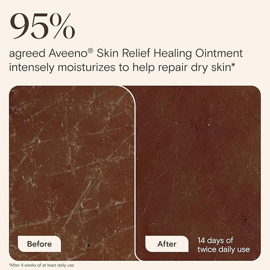 Aveeno Skin Relief Healing Ointment, Repair & Protect Extra Dry, Cracked Skin, Glycerin Protectant with Triple Oat & Shea Butter, Fragrance-Free & Non-Greasy Feel, Travel Size, 2.0 oz (Pack of 3)