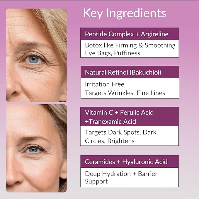 LeVaye Strateva RX Advanced Anti-Aging Serum – Vitamin C, Niacinamide, Natural Retinol, Hyaluronic Acid & Peptides – Targets Wrinkles, Fine Lines, Dark Spots, Dark Circles & Enlarged Pores