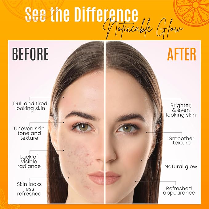 30% Vitamin C Serum (8 Fl Oz) Pure Organic Anti- Wrinkle + Hyaluronic Acid + Retinol + Vitamin E + Vitamin B, Facial Serum For Anti-aging, Wrinkles, And Fine Lines.