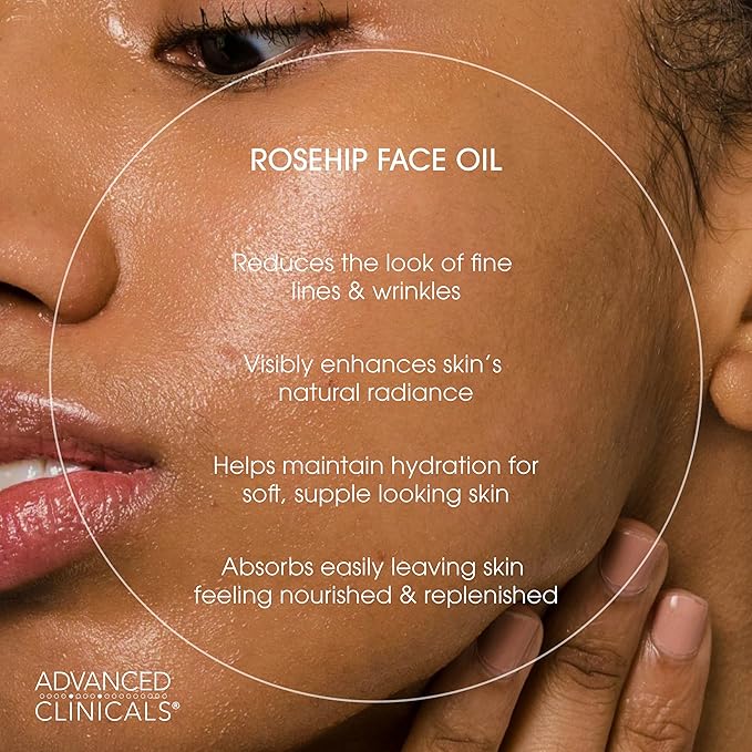 Advanced Clinicals Rosehip Oil For Face With Vitamin E + Botanicals Helps Improve Look Of Dark Spots, Wrinkles, Fine Lines, & Uneven Looking Skin Tone | Moisturizing Skin Care Face Serum, 1.8 Fl Oz